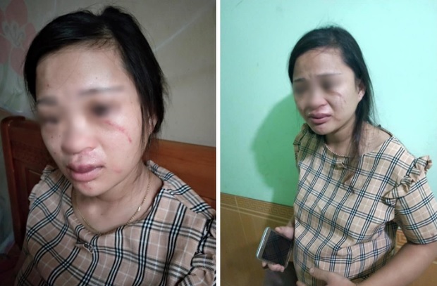 Xót xa những người vợ bầu vượt mặt vẫn đau đớn chịu nhiều trận bạo hành của chồng vũ phu