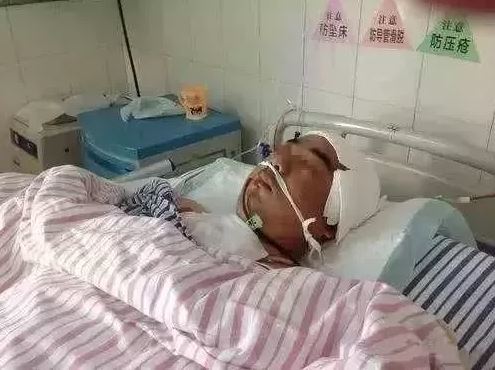 Người đàn ông đột quỵ trong giấc ngủ vì hành động sai lầm sau uống rượu - 1
