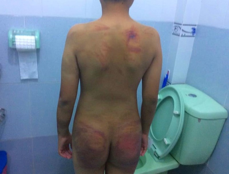 Bé trai 11 tuổi bị 1 người tu hành đánh dã man - ảnh 4