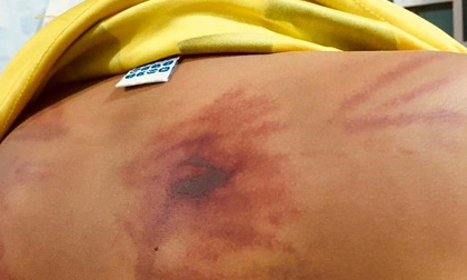 Bé trai 11 tuổi bị 1 người tu hành đánh dã man