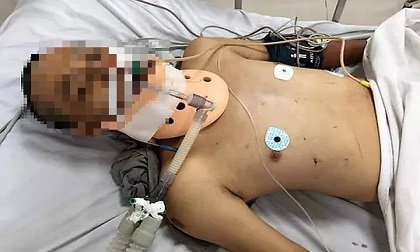 Đi bộ xuyên Việt, người đàn ông bị tai nạn tử vong tại Quảng Bình