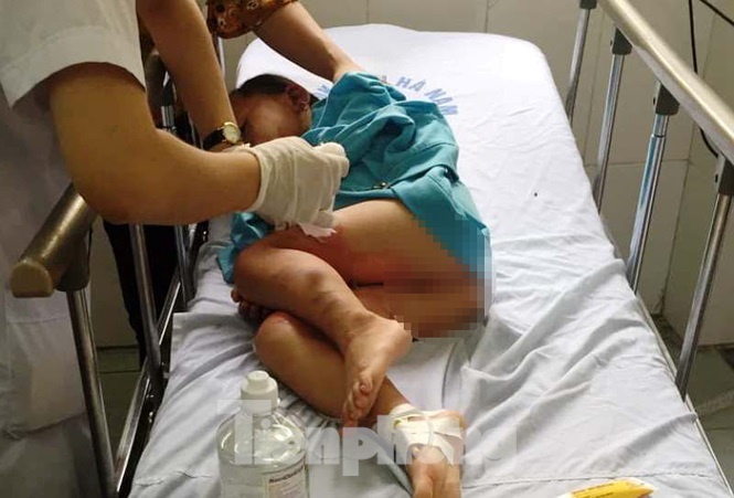 Dạy kỹ năng phòng chống cháy nổ bằng cồn, 3 trẻ mầm non bị bỏng nặng - 2