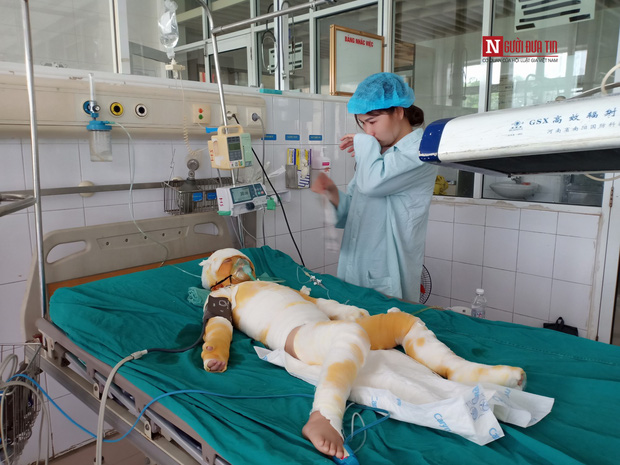Vụ cô giáo đốt cồn dạy phòng chống cháy nổ: Nghẹn ngào lời kể của người mẹ trẻ - 1