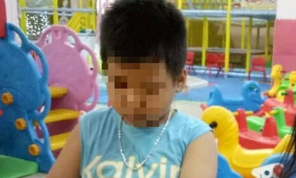 Bị vợ cũ tố cùng vợ mới bạo hành con trai 12 tuổi dã man, đốt cả túi nylon để nhỏ vào mông bé, người bố nói gì?