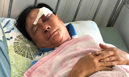 Con rể cầm chai bia đánh cha vợ bầm mắt phải cấp cứu