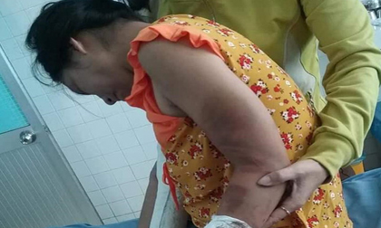 Gã chồng hờ đánh vợ đang mang thai gãy tay chân bất ngờ bỏ trốn