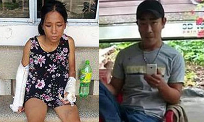 Gã chồng đánh vợ bầu 7 tháng đến gãy tay chân bị tạm giam 3 tháng