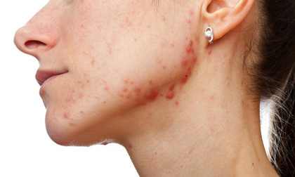 7 'báo động đỏ' trên cơ thể tiết lộ sức khỏe có vấn đề