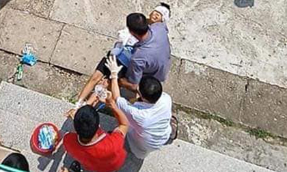 Đang ngủ, bé trai 10 tuổi bị bác họ vác dao chém đứt lìa tay
