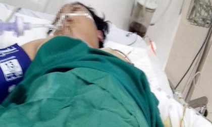 Chồng tưới xăng đốt thai phụ, 2 người thương vong