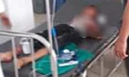 Bé trai bị chú họ dùng dao chém đứt lìa bàn tay: Mắt trái đã bị hỏng hoàn toàn