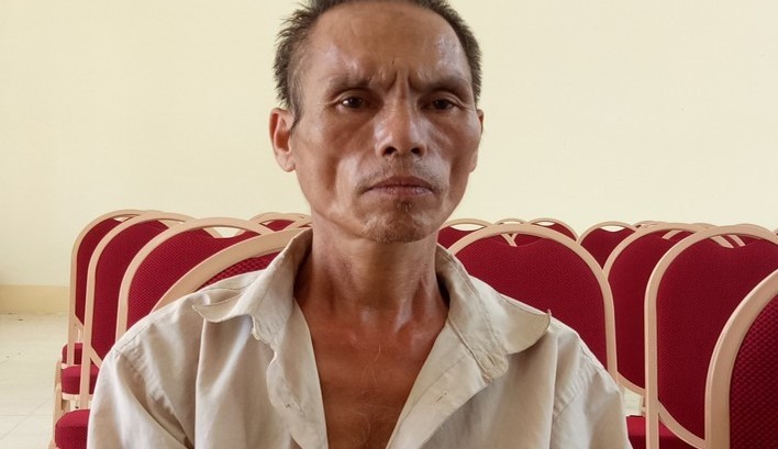 Bé trai bị chú họ dùng dao chém đứt lìa bàn tay: Mắt trái đã bị hỏng hoàn toàn - 1