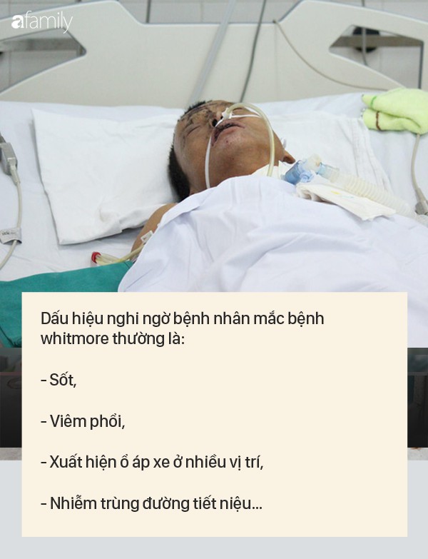 Dấu hiệu bệnh whitmore - căn bệnh do vi khuẩn ăn mòn cơ thể con người, có thể gây tử vong trong vài ngày - 1