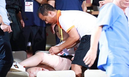 CĐV nữ nhập viện cấp cứu vì pháo sáng rơi trúng chân