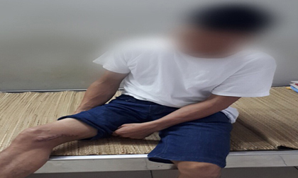 Người đàn ông nhiễm vi khuẩn Whitmore từng khiến 4 bệnh nhân Bạch Mai tử vong