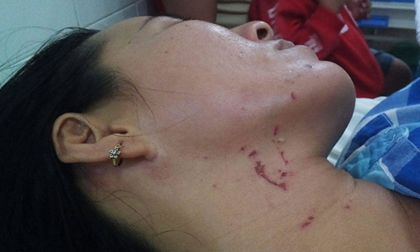 Củng cố hồ sơ vụ chồng đánh đập, dìm vợ xuống nước ở Tây Ninh để xử lý nghiêm