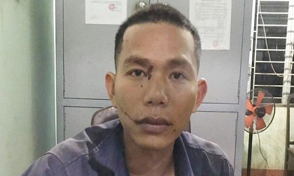 Chém chết tình địch rồi đến công an đầu thú