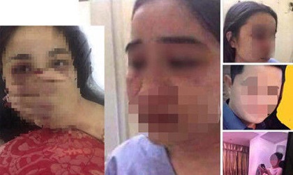 Tiết lộ bất ngờ về căn phòng nơi bác sĩ đánh nữ sinh nhập viện