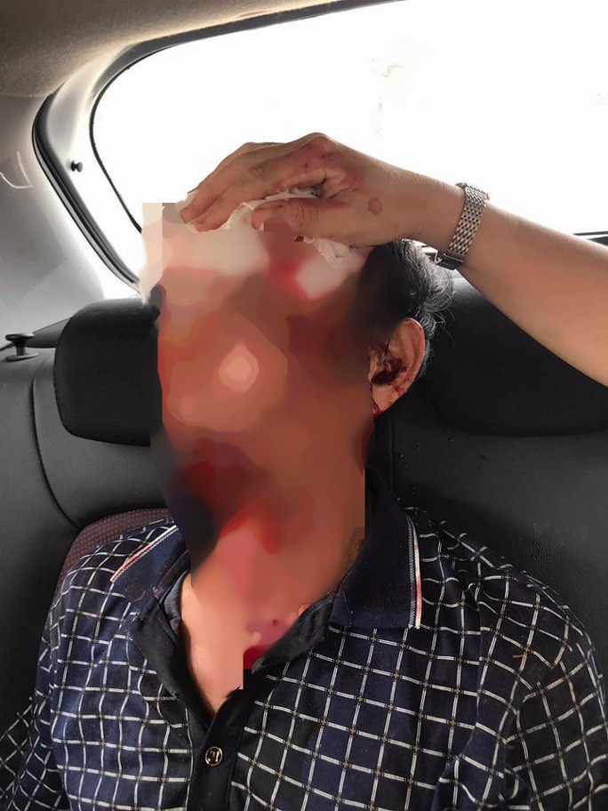 vu no sung, 3 nguoi bi thuong: nan nhan he lo nguyen nhan khong ngo hinh anh 2