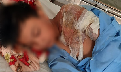 Xác minh thông tin bé trai ở Long An bị cha đẻ bạo hành, đổ nước sôi khiến bỏng nặng phải nhập viện