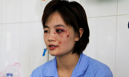 Nữ phụ xe bị 5 thanh niên đánh nhập viện: ‘Tôi tủi thân và ám ảnh’