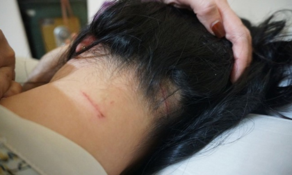 Khởi tố, bắt tạm giam cựu cán bộ công an đánh vợ cũ dã man