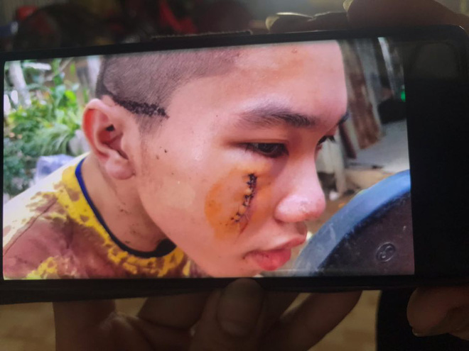 Công an vào cuộc vụ nhóm người xông vào ‘Tịnh thất Bồng Lai’ tìm con gái, đánh một người bị thương - 1