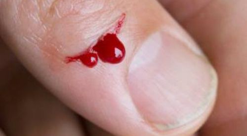 Tránh xa gừng nếu bạn mắc các bệnh sau kẻo