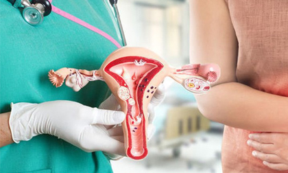 3 vị trí trên cơ thể phụ nữ chuyển màu đen là cảnh báo căn bệnh nguy hiểm, rất nhiều người mắc phải