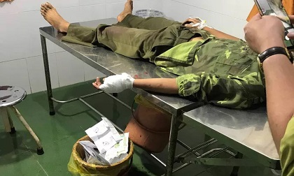 Hàng chục lâm tặc vây chém kiểm lâm, giải cứu đồng bọn