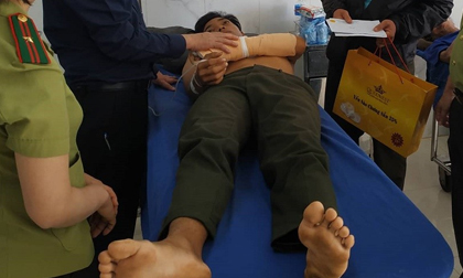 Kinh hoàng lời kể của cán bộ kiểm lâm bị nhóm lâm tặc chém trọng thương