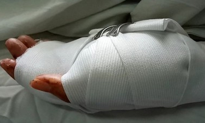 Đắk Nông: Tranh chấp đất rẫy, cô giáo bị chồng cũ chém gần đứt lìa 2 bàn tay