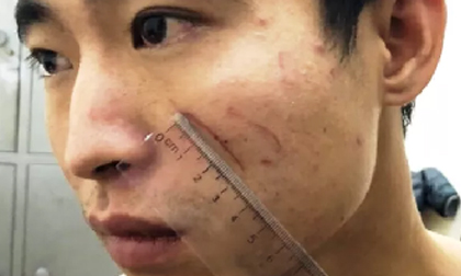 Hé lộ nguyên nhân thanh niên dùng chăn giết người yêu trong nhà nghỉ