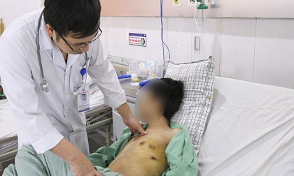Hút thuốc lá 5 năm, chàng trai 23 tuổi bị tràn khí màng phổi