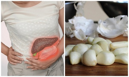 Tỏi rất tốt cho sức khỏe, nhưng chế biến với các thực phẩm sau là đại kỵ, 'ủ bệnh' cho cả nhà