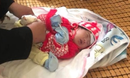 Bé gái sơ sinh tật nguyền bị mẹ bỏ rơi bên đống gạch trước cổng chùa