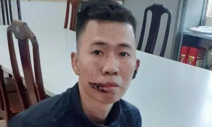 Bắt nghi phạm giết mẹ, chém cha bị thương