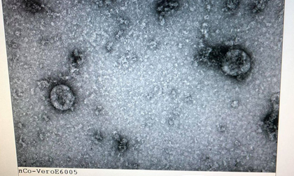 Tin vui: Việt Nam nuôi cấy và phân lập thành công virus corona mới