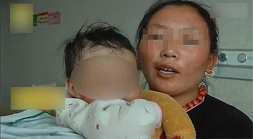 Bé gái năm tháng mắc sỏi thận