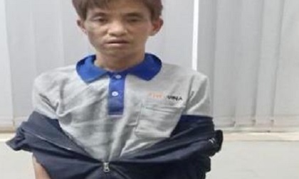 Rút dao chống trả, tên trộm xe vẫn không thoát