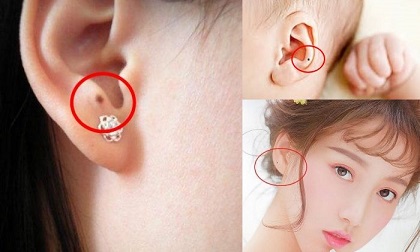 Thầy tướng số hé lộ: 5 nốt ruồi 'thần Tài', ai có một cái là hưởng 'no' lộc vàng rung đùi hưởng phúc