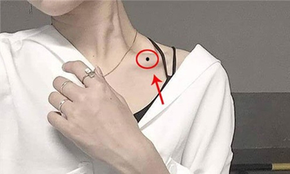 Vị trí nốt ruồi 'phản chủ' kéo hết vận xui về người, xóa ngay nếu không muốn bị phá lộc phá duyên