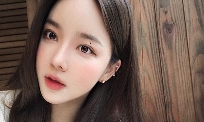 3 nốt ruồi 'lộc vàng' báo hiệu chủ nhân là người có số giàu sang