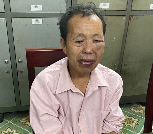 Mot cong an hy sinh khi vay bat toi pham ma tuy hinh anh 1 Do.jpg