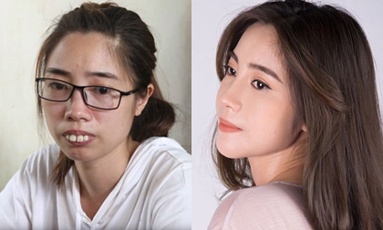 Cô gái Phú Thọ mong tìm được bạn đời sau hành trình phẫu thuật thẩm mỹ