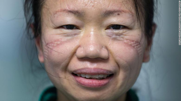 Chân dung y tá  Cao Shan