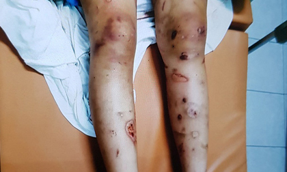 Nhóm người tra tấn thiếu nữ đến chết thai, mang xác trẻ sơ sinh đi bỏ