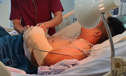 Vụ người đàn ông bị dùng mã tấu chém đứt lìa cẳng tay kinh hoàng ở TP.HCM: Nạn nhân nói gì?
