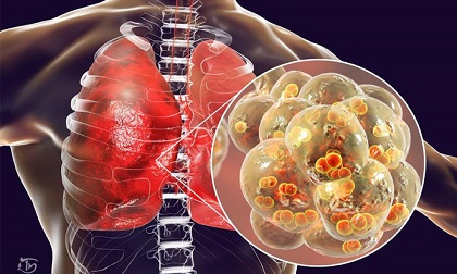 Phòng chống Covid-19: Những việc cần phải làm mỗi ngày để giữ phổi khỏe mạnh