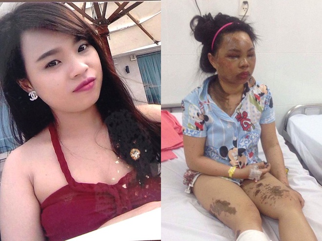 Noi dau cua ca gia dinh bi tat axit hinh anh 1 6_tat_acid_henq.jpg